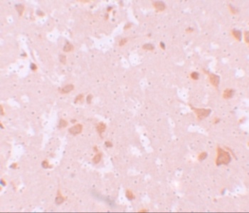 NALP7 Antibody