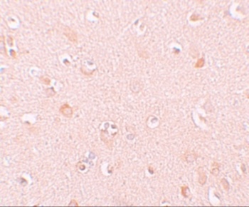 NALP5 Antibody