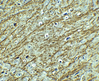 GATA3 Antibody