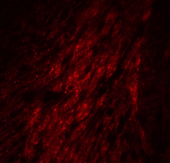 GATA3 Antibody