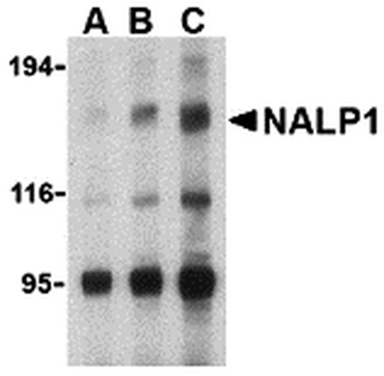 NLRP1 Antibody