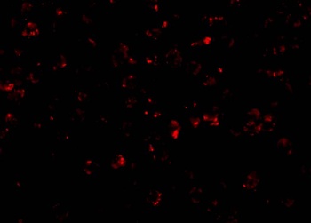 NALP1 Antibody