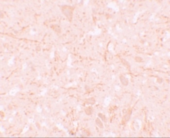 NALP12 Antibody