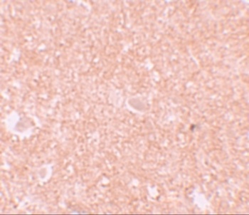 NLRP10 Antibody