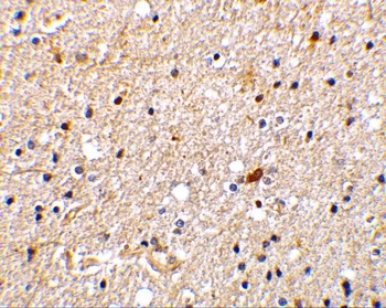 NADE Antibody