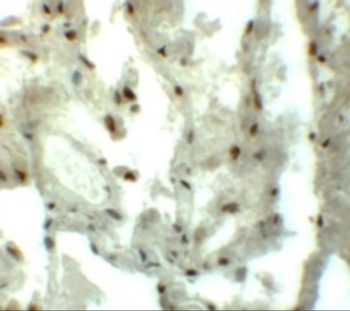 MYOZAP Antibody
