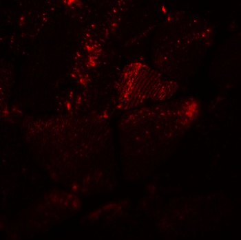 MYH8 Antibody