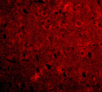 GPAT1 Antibody