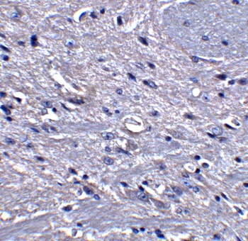 GPAT1 Antibody