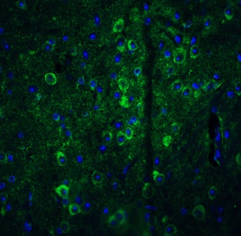 GPAT1 Antibody