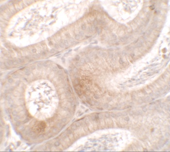 MTERFD3 Antibody