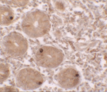 MTERFD2 Antibody