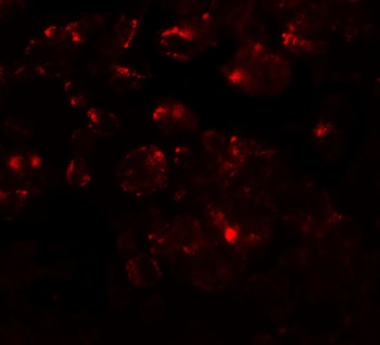 MTERFD1 Antibody