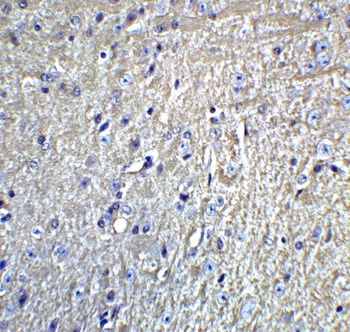 GRIK1 Antibody