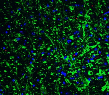 Grik1 Antibody