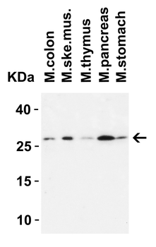 MEOX1 Antibody