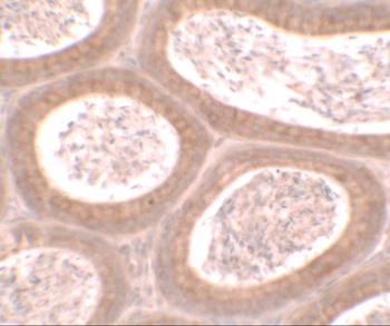 MOSPD1 Antibody