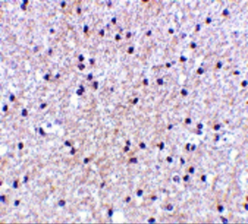MORF4 Antibody