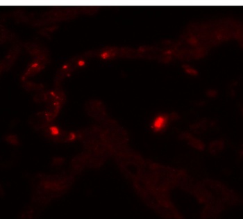 MMP9 Antibody