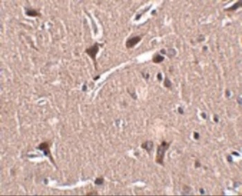 ZNF667 Antibody