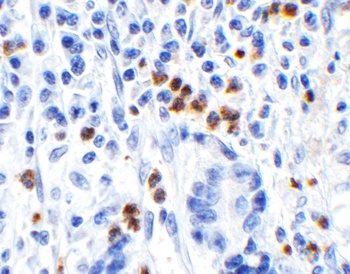 HMGB1 Antibody