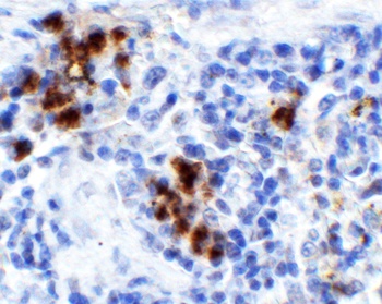 HMGB1 Antibody