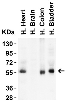 hRIP3 Antibody