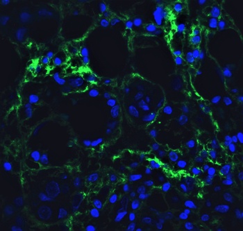 hRIP3 Antibody