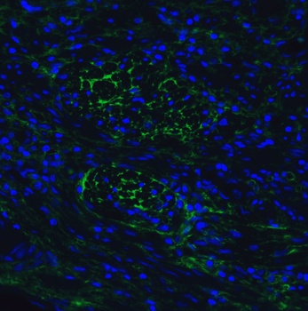 hRIP3 Antibody