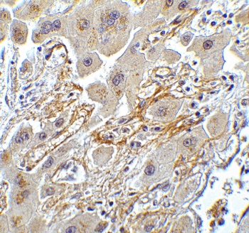 hRIP3 Antibody