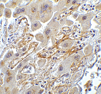 Ripk3 Antibody