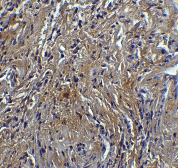 hRIP3 Antibody