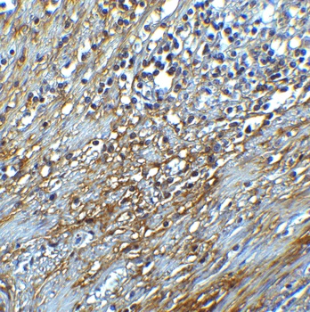 hRIP3 Antibody