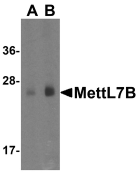 MettL7B Antibody