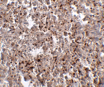 METTL7B Antibody