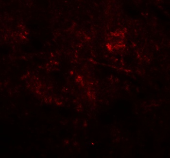 MEK1/2 Antibody