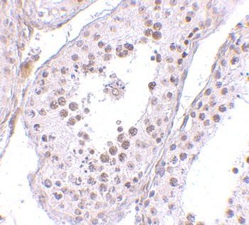 MED4 Antibody