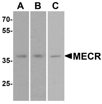 MECR Antibody