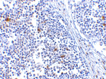 MDA5 Antibody