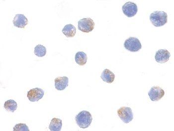 CHUK Antibody