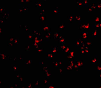 CHUK Antibody