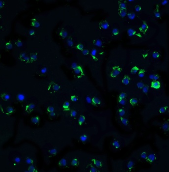CHUK Antibody