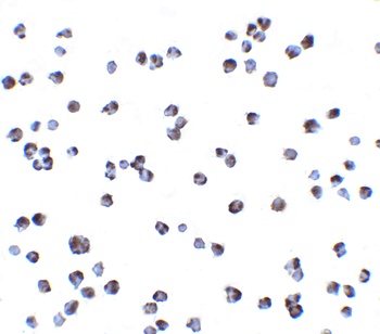 CHUK Antibody
