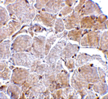 MAPKAP1 Antibody