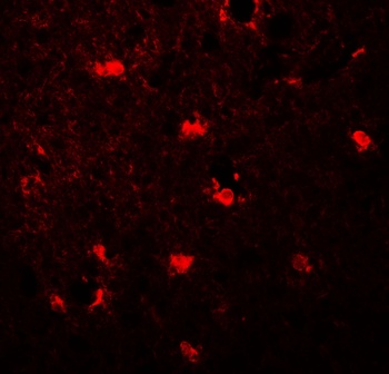 MAP1LC3C Antibody