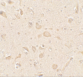 MAP1LC3B Antibody