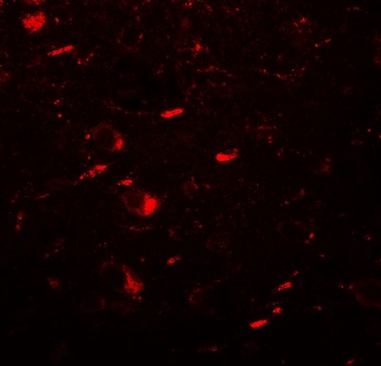 MAP1LC3B Antibody