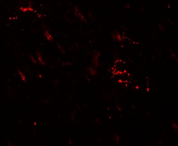 MAP1LC3A Antibody