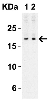 IL17A Antibody