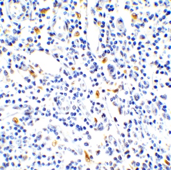 IL-17 Antibody